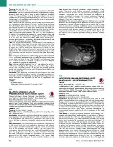 130 bilateral urinomas: a rare presentation of acute kidney injury