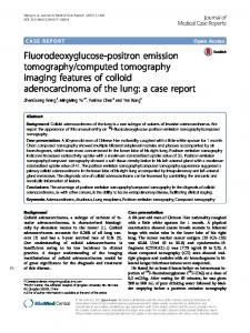 Fluorodeoxyglucose-positron emission tomography/computed ...