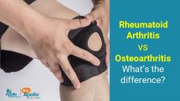 Rheumatoid Arthritis  vs Osteoarthritis